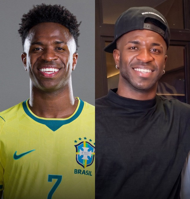 Vinicius Junior estetik yaptırdı, bambaşka birine dönüştü! - Resim : 2