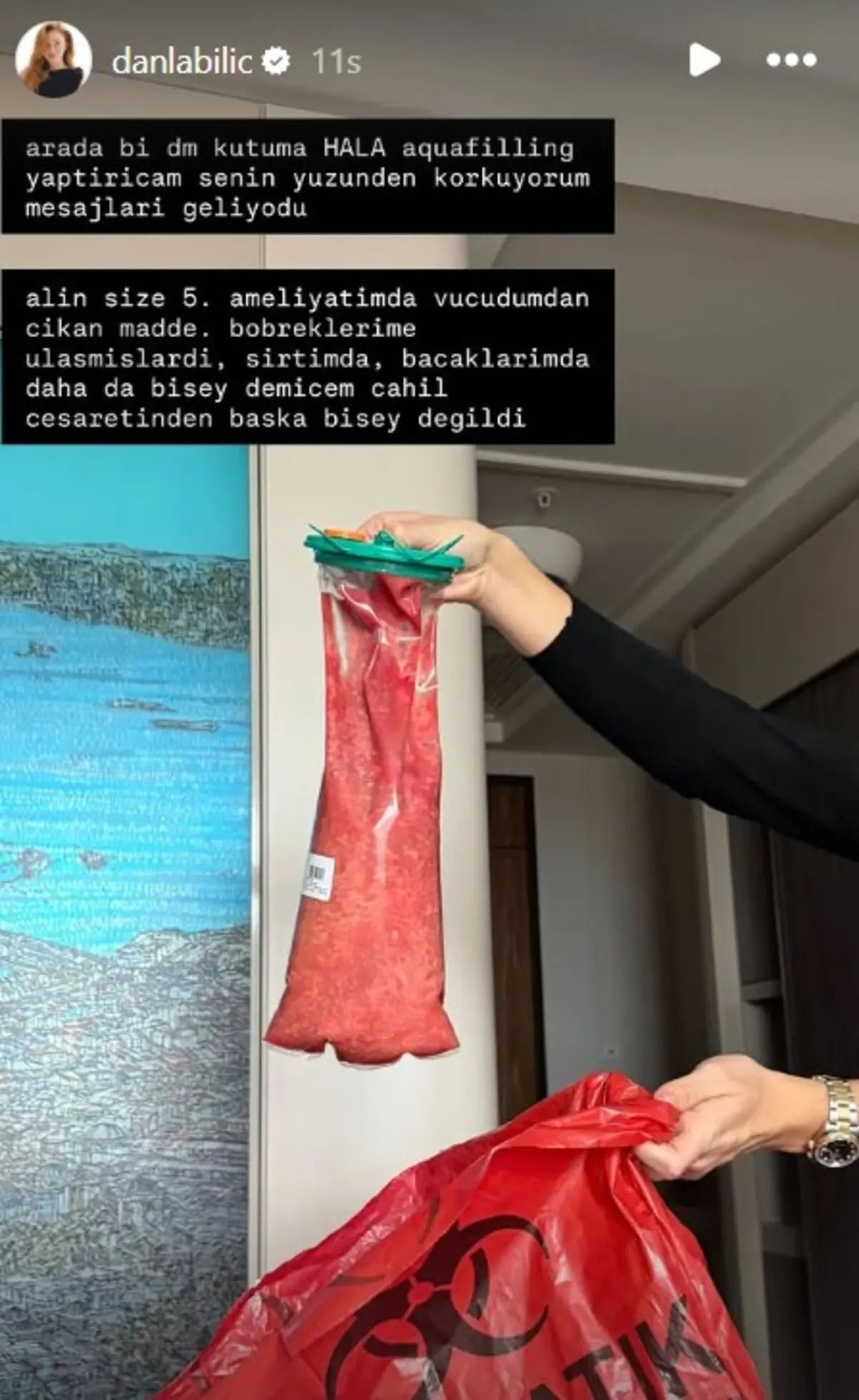Danla Bilic hakkında korkutan iddia! Durumu ağırlaştı, hastaneye kaldırıldı - Sayfa 4