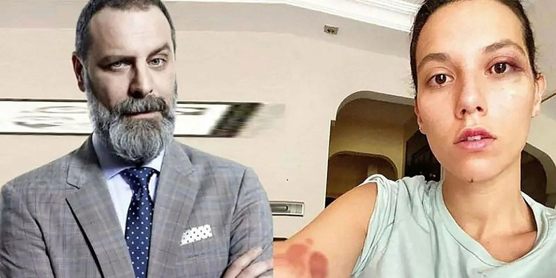 Ozan Güven’den yıllar sonra gelen itiraf! Darp gerekçesiyle ceza almıştı… - Sayfa 2